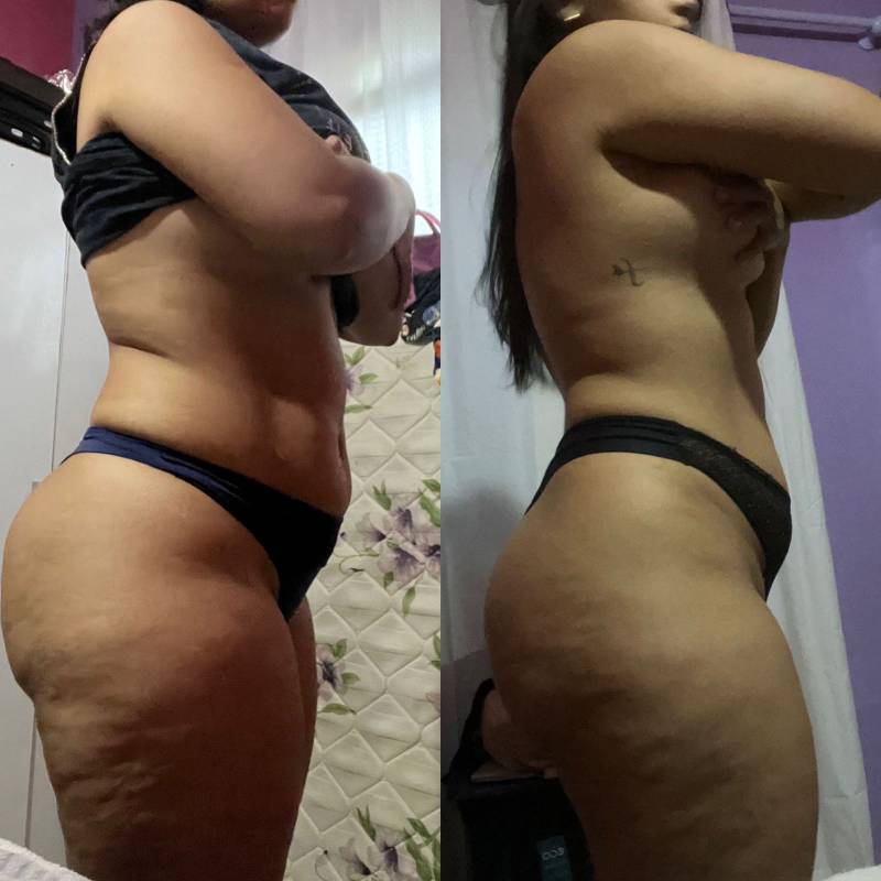CRISTIAN-ANTES-E-DEPOIS-8.jpg